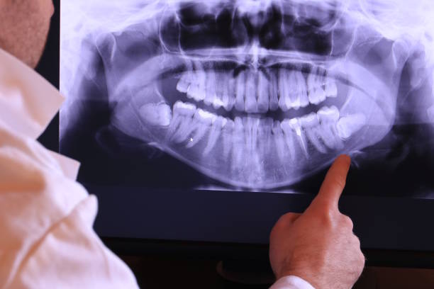 Best Mobile Emergency Dentist in Lake Ketchum, WA